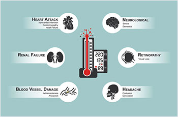 Patient Resources :: SHS – Hypertension Management Organisation Singapore